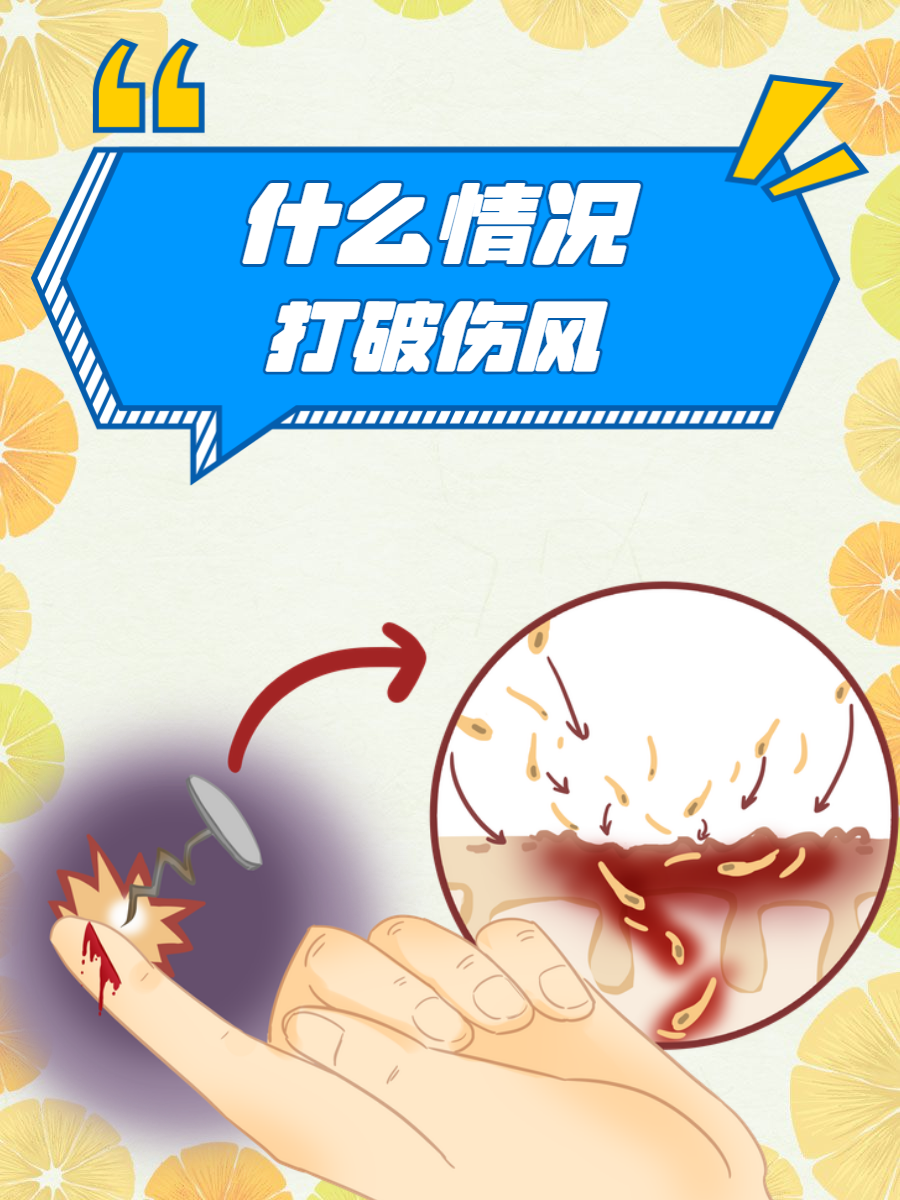 焦急是个什么词